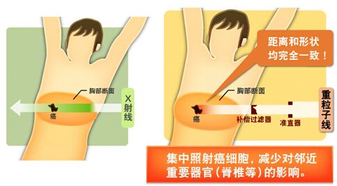 新技術(shù)定向治療示意圖
