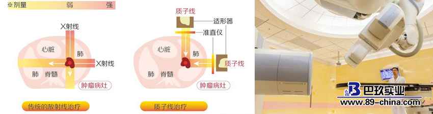 質(zhì)子重離子治療癌癥示意圖